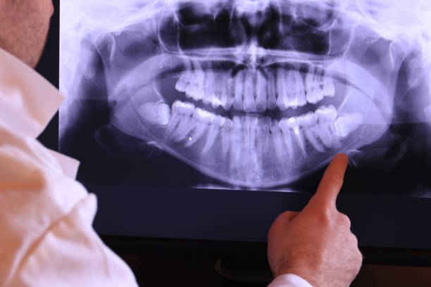 Best Emergency Treatment for Jaw Pain or Injury in Burlington, WI