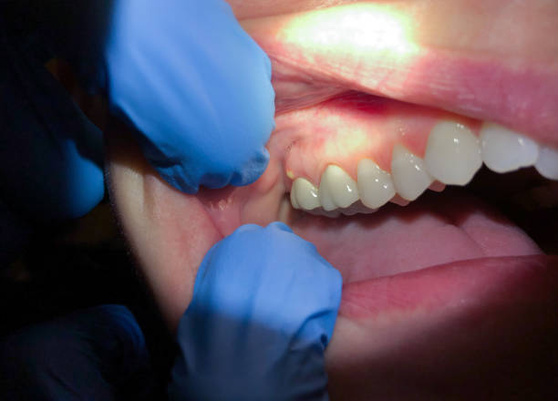 Professional Emergency Dental Service in WI