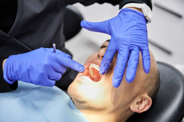 Best Emergency Care for Gum Disease in Burlington, WI